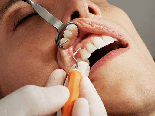 Studio Dentistico Dott.ssa Colella Camilla