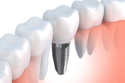 Studio Dentistico Centro Odontoiatrico Procaccini