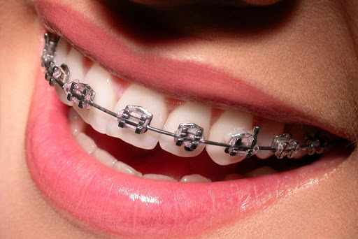 Studio Dentistico Andreani Dr.ssa Francesca