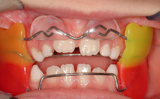 Studio Dentistico Dr.ssa Laura Ferri