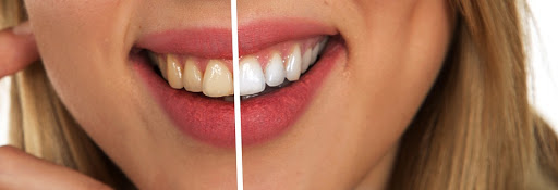 Studio Dentistico Dr. Aldo Di Gregorio