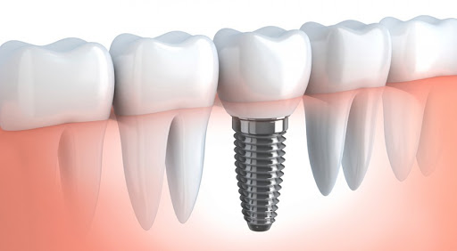 Studio Dentistico Dott. Ricci