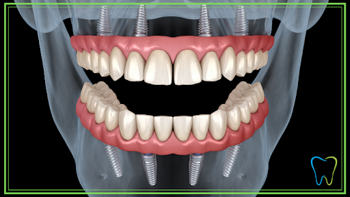 Studio Dentistico Riparazione Protesi Dentarie logo
