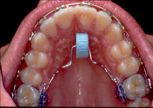 Studio Dentistico Dr.Luca Lucarini ORTODONZIA