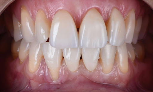 Studio Dentistico Odontoiatrica Apollonia sas stp