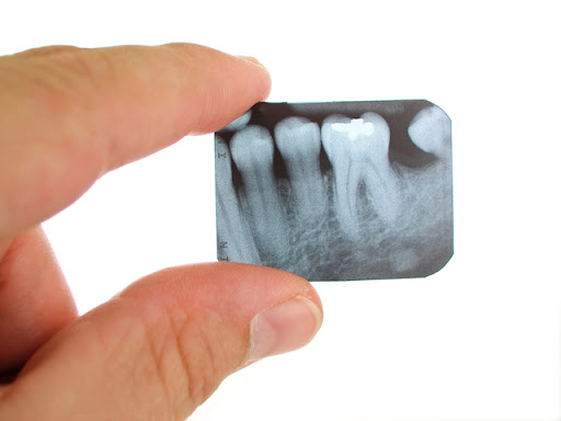 Studio Dentistico Cavalieri Dr. Fabrizio Dentista