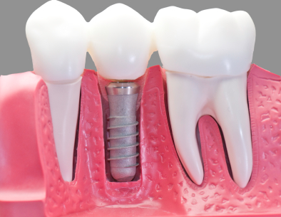 Studio Dentistico Dr. Gabriele Gagliardini