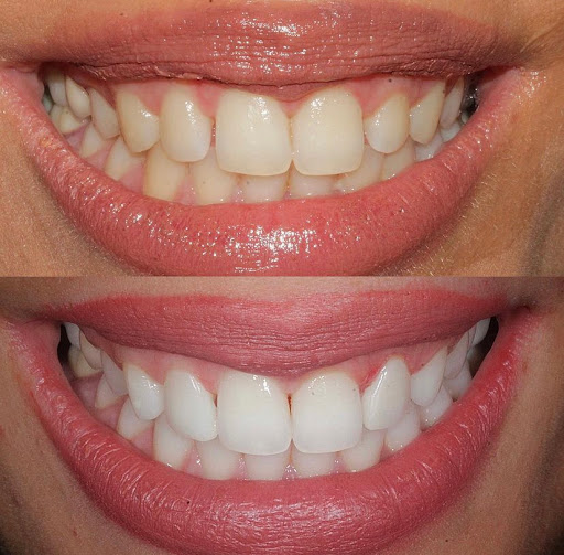 Studio Dentistico Dr Gianni Zega